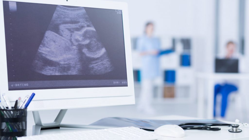 pantalla computadora con ecografía de feto